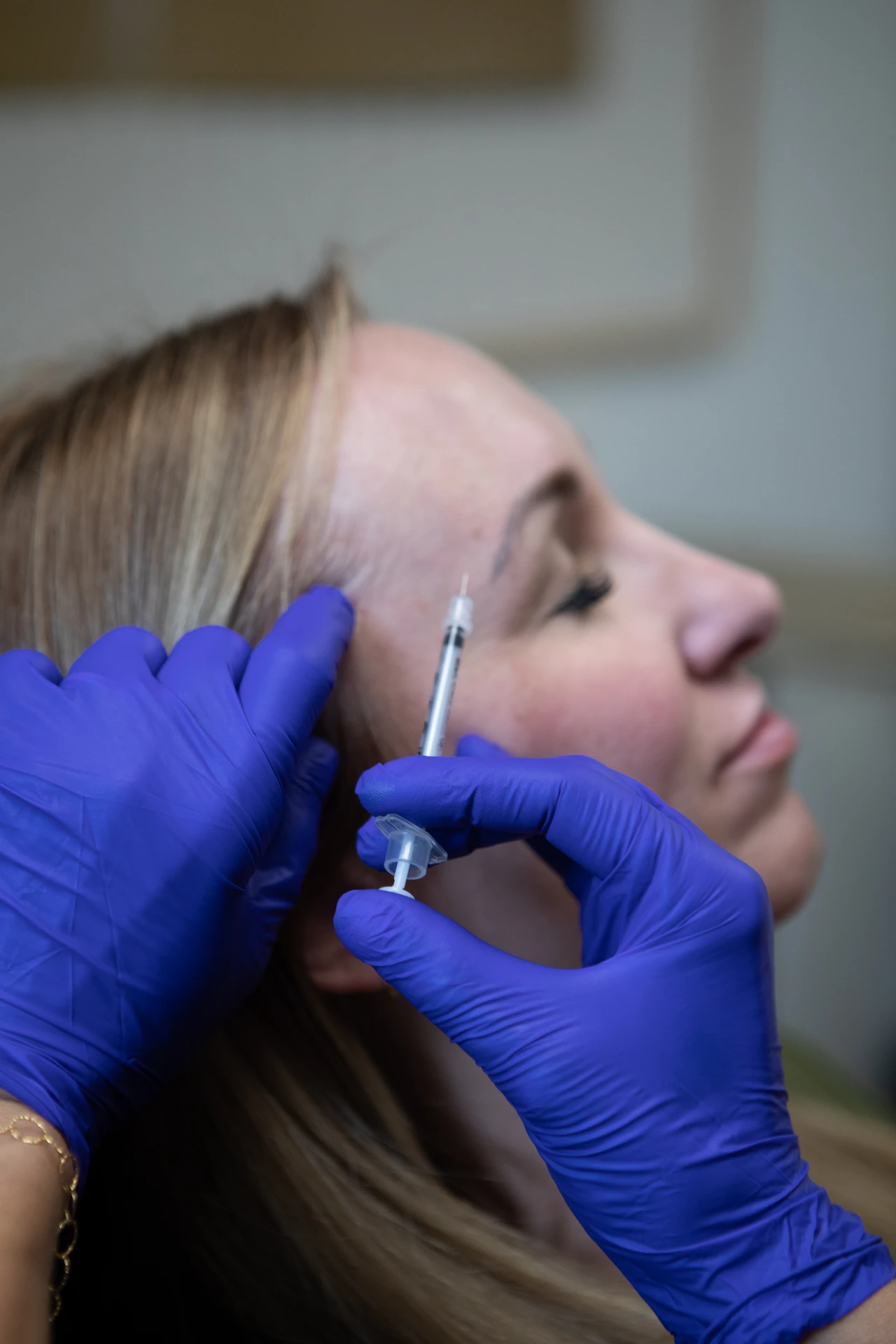 woman having injection on the side of her brow