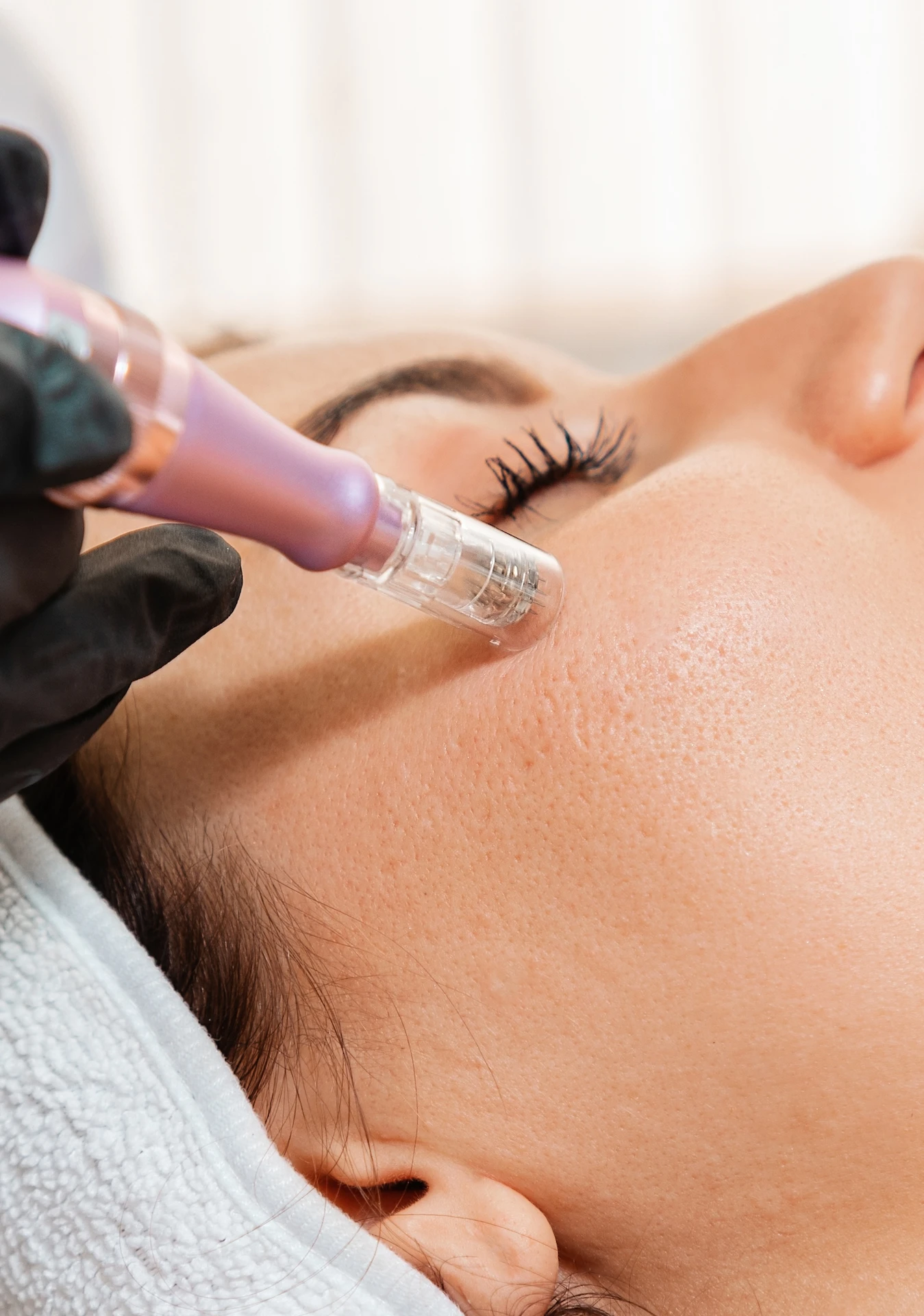 woman having treatment on her cheek