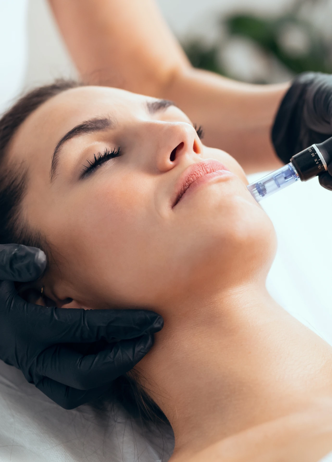 woman having treatment on her cheeks