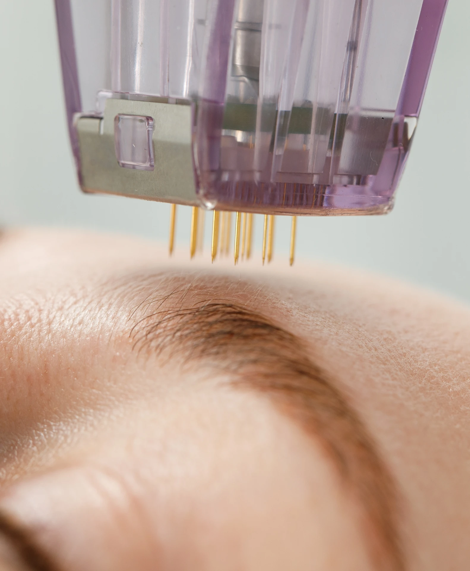 woman having treatment on her eye brow