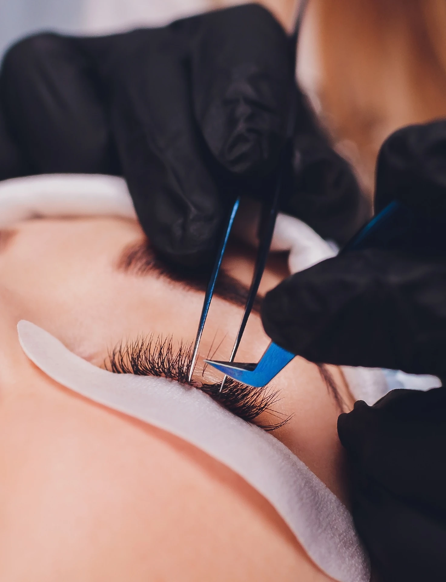 woman having work done on her eye